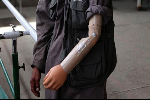 Crean en Argentina el primer brazo ortopédico inteligente